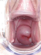 Large Labia and Vagina Picture from ITC